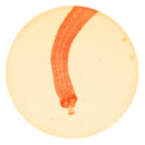 תצלום מיקרוסקופ של שרשור ננסי